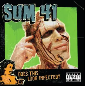 Sum41 - Does This Look Infected?
